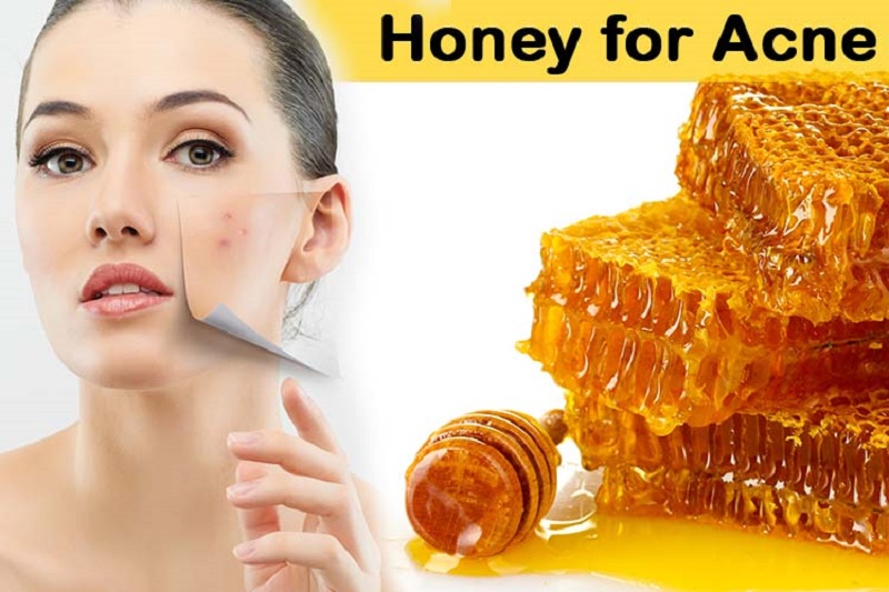 pimple treatment with honey