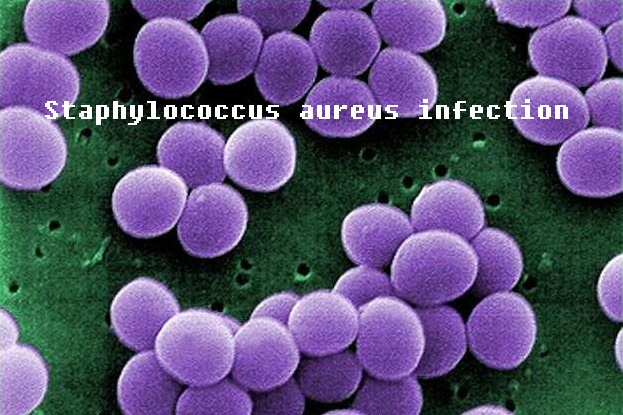 Staphylococcus aureus infection