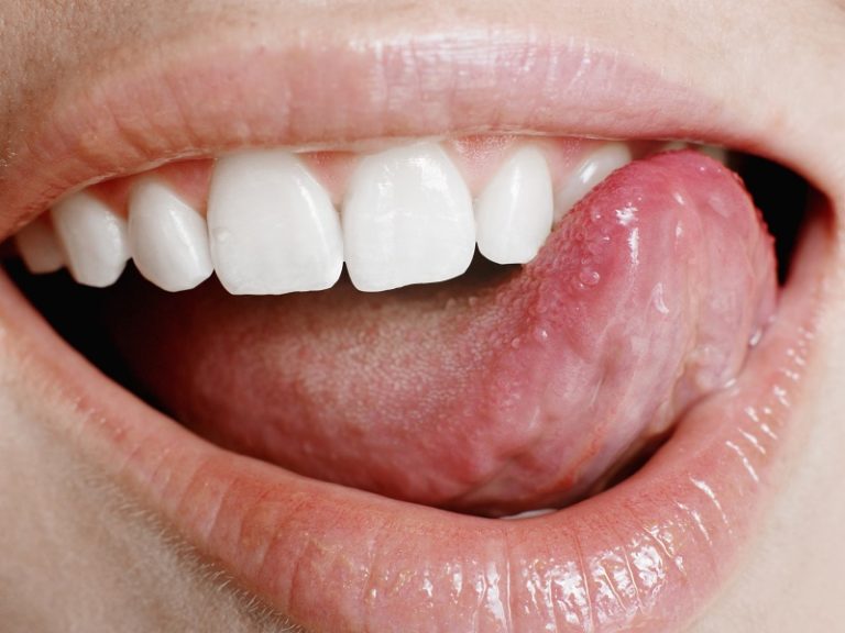 Why tongue pain happens and how to cure it? Healthy Flat